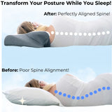 PainAway™ Contour Pillow -  50% OFF Untl Stock Lasts